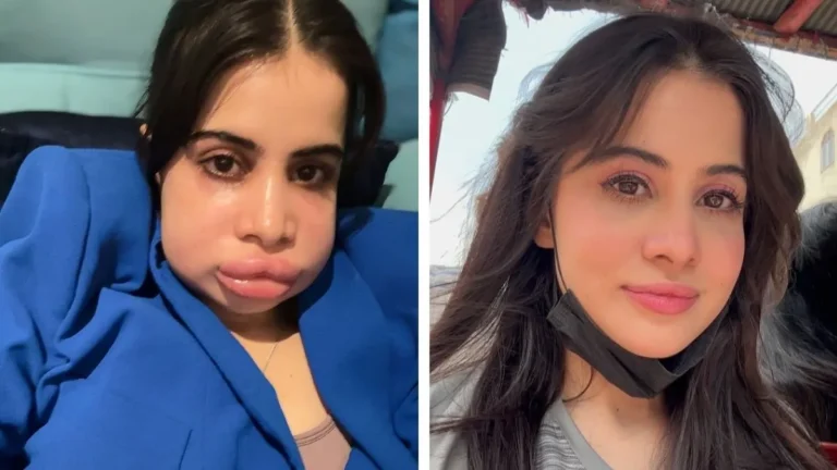Uorfi Javed is flaunting her lips, and shutting down haters with confidence